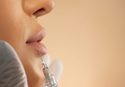 preenchimento labial